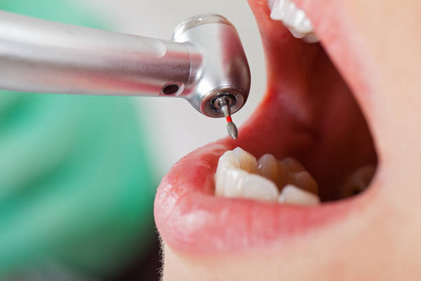 Best Dental Abscess Treatment in Towanda, KS